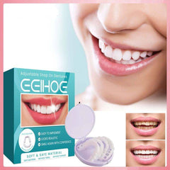 إبتسامة هوليود سمايل